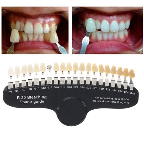Dental Tooth Shade Chart Printable